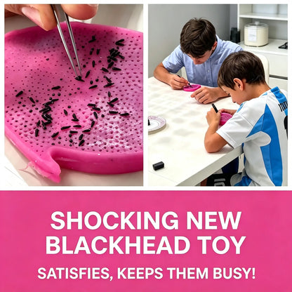 Dragon Fruit Seed Picking Fidget Toy with Metal Tweezers [YQT:ULO-260922-002:9cc3d10f21db1925]